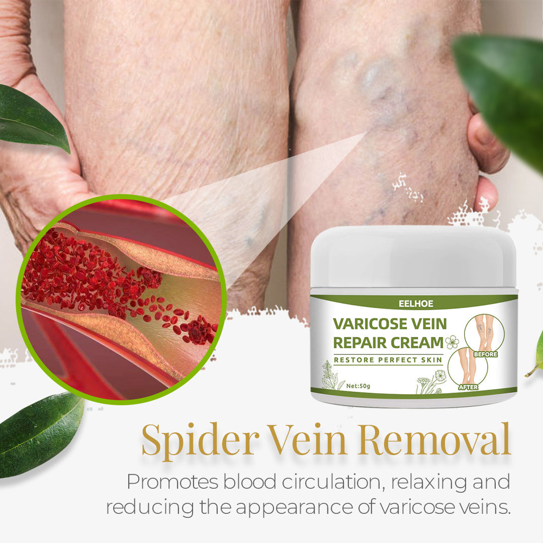 Varicose⢠Vein Repair Cream (Point AAD Recommended) for Varicose Vein Removal, Spider Veins
