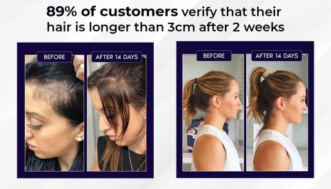 šæ Odeiun⢠Natural Hair Regrowth Spray ā 70% OFF Ends Tonight! š„