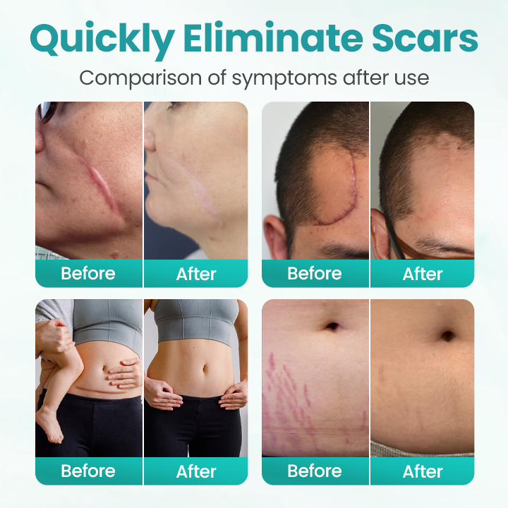 Seurico® EliteAloe ScarSolve Spray