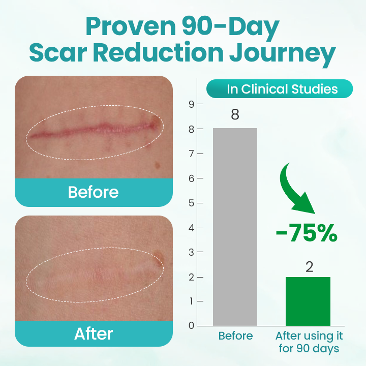 Seurico® EliteAloe ScarSolve Spray