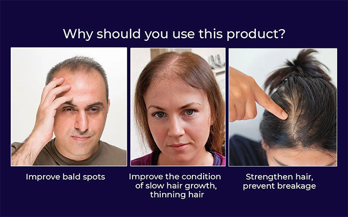 šæ Odeiun⢠Natural Hair Regrowth Spray ā 70% OFF Ends Tonight! š„