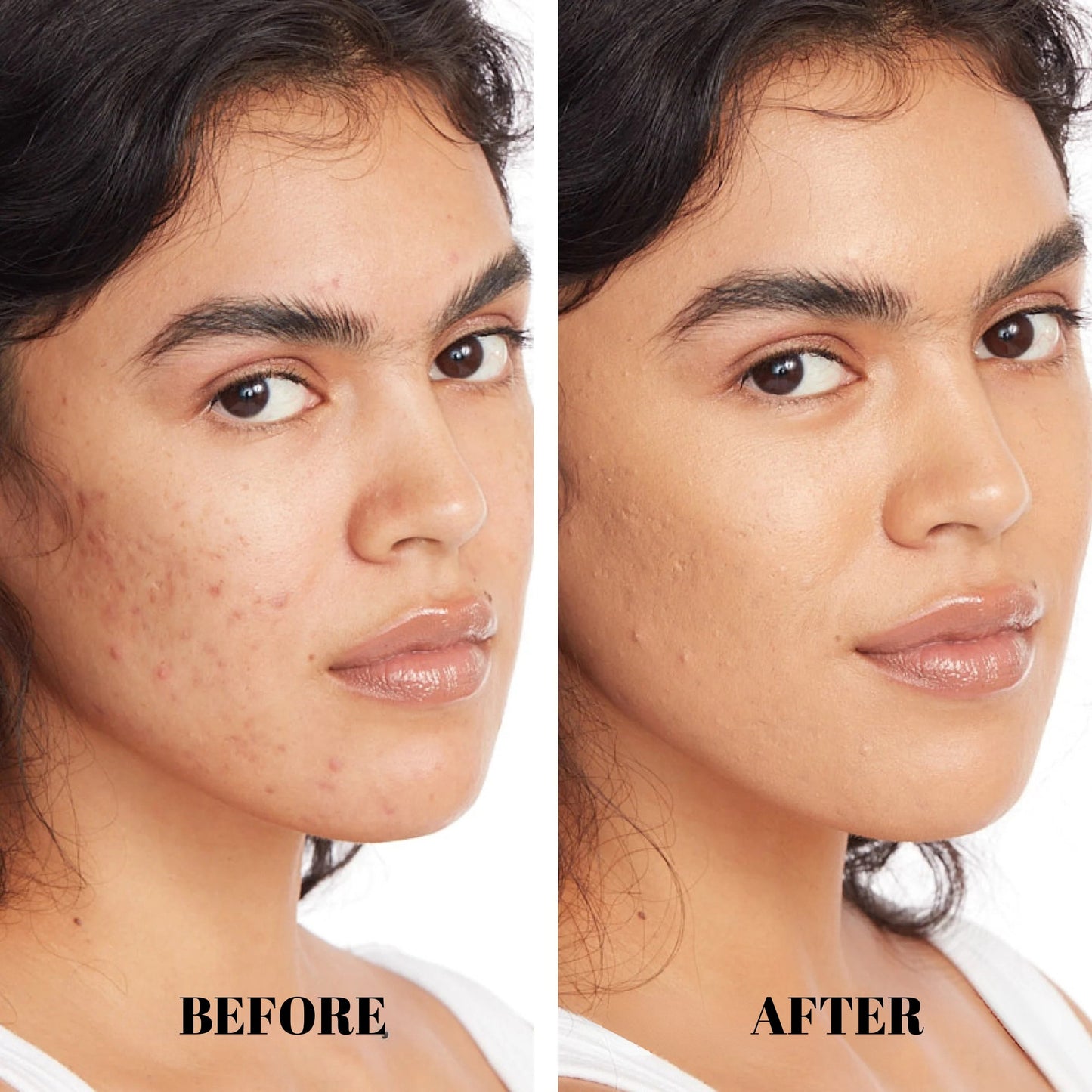 Seurico™ Cream - An all-in-one for moisturizing, concealing and coverage