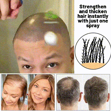 šæ Odeiun⢠Natural Hair Regrowth Spray ā 70% OFF Ends Tonight! š„