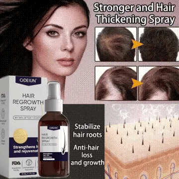 šæ Odeiun⢠Natural Hair Regrowth Spray ā 70% OFF Ends Tonight! š„