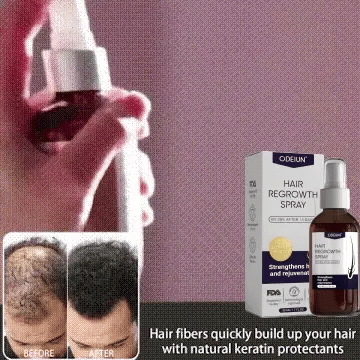 šæ Odeiun⢠Natural Hair Regrowth Spray ā 70% OFF Ends Tonight! š„