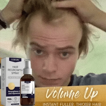 šæ Odeiun⢠Natural Hair Regrowth Spray ā 70% OFF Ends Tonight! š„