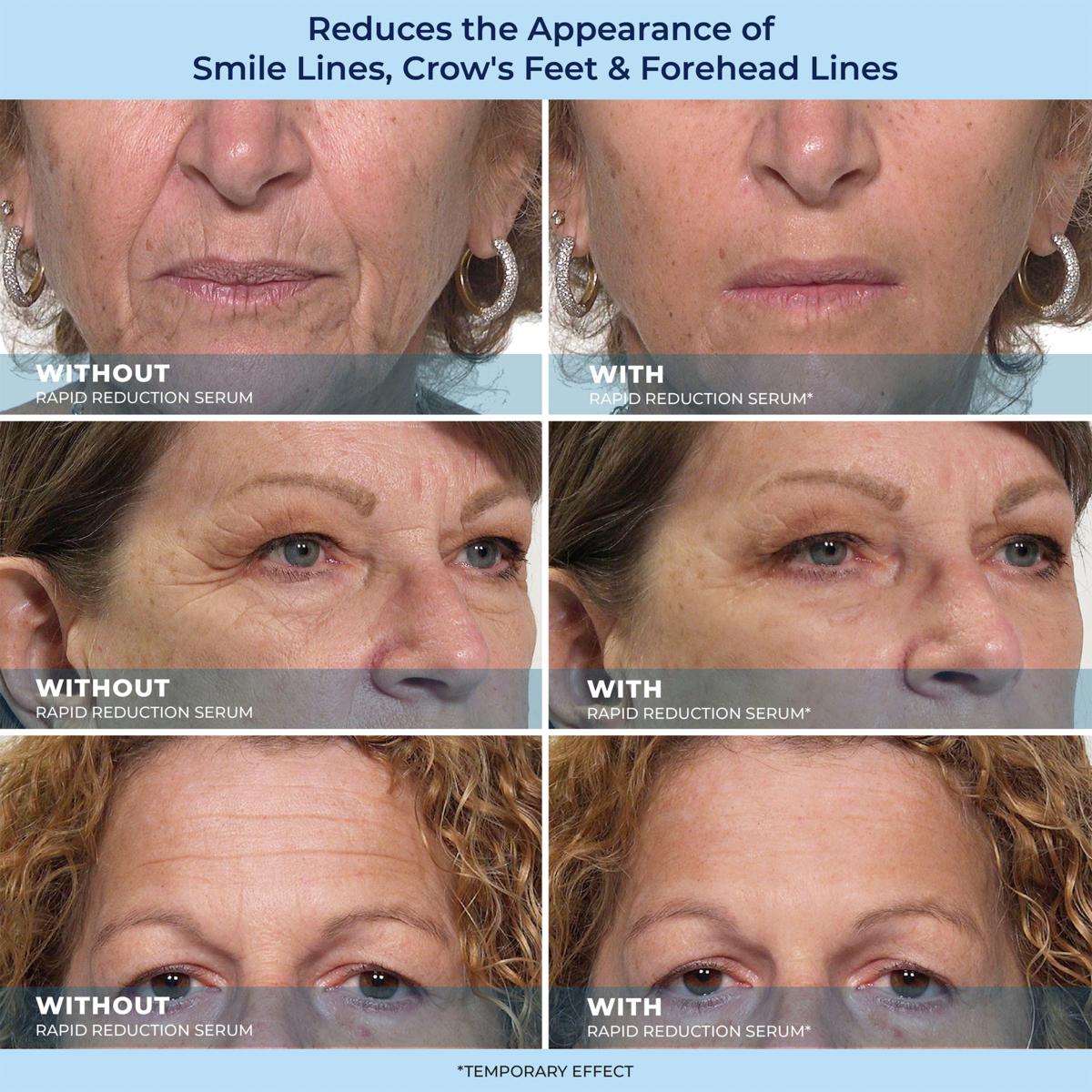 💥July Sale Frenzy💥 Plexadern™ 60-Second Anti-Aging Serum for Wrinkles, Bags & Dark Circles