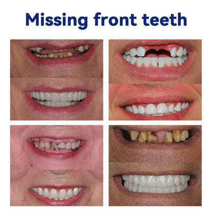 NEGUSY™ Silicone Denture Ruler Set (👩‍⚕️ADA Compliant Approved By Professional Dentists)