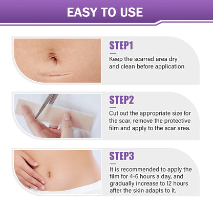 ✅Official Store |NEGUSY® Hyaluronic Acid Nano Microneedle Repair Tape🏥(Treatment of old and new scars, reduction of surgical scars, stretch marks, keloids, acne, burns, warts, dermatomes and varicose veins)