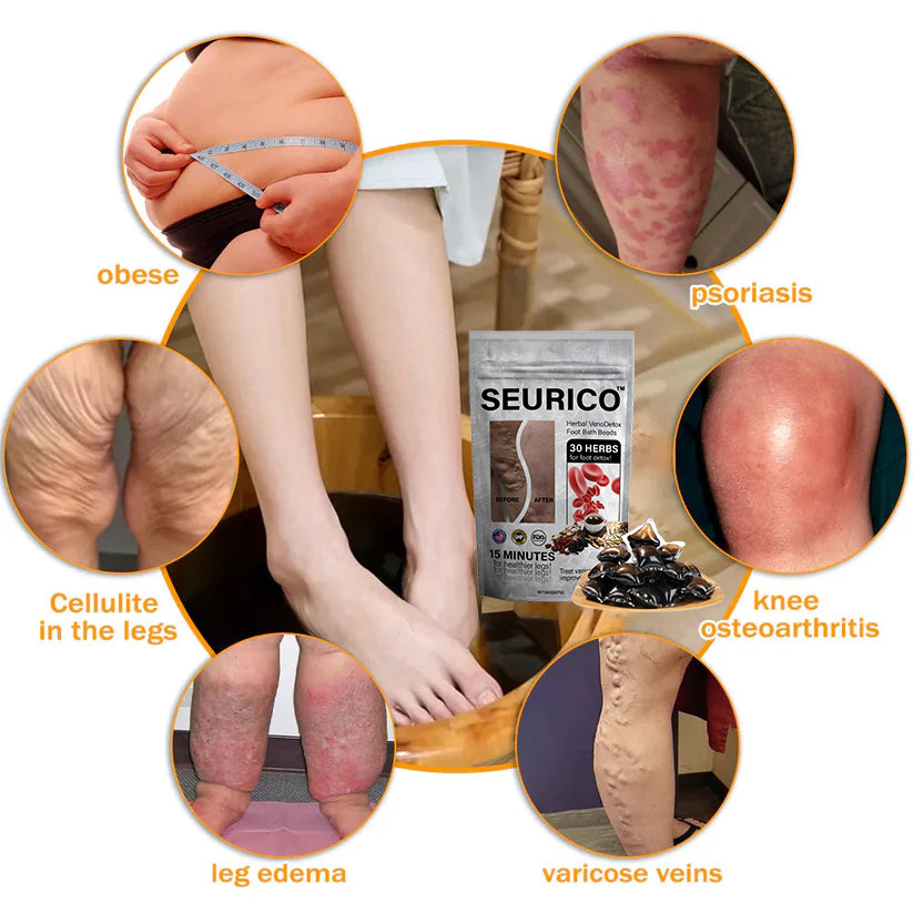 Seurico™ Herbal VenoDetox Foot Bath Beads🌲(𝐋𝐀𝐍𝐀 𝐂𝐞𝐫𝐭𝐢𝐟𝐢𝐜𝐚𝐭𝐢𝐨𝐧，𝗟𝘆𝗺𝗽𝗵𝗮𝘁𝗶𝗰 𝗔𝘀𝘀𝗼𝗰𝗶𝗮𝘁𝗶𝗼𝗻 𝗼𝗳 𝗔𝗺𝗲𝗿𝗶𝗰𝗮)