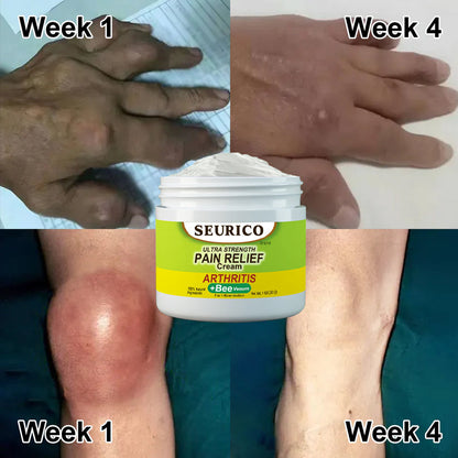 Seurico™ Bee Venom Joint & Bone Therapy Cream (Full Body Recovery, Pure Natural Formula)