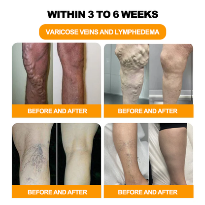Seurico™ Herbal VenoDetox Foot Bath Beads🌲(𝐋𝐀𝐍𝐀 𝐂𝐞𝐫𝐭𝐢𝐟𝐢𝐜𝐚𝐭𝐢𝐨𝐧，𝗟𝘆𝗺𝗽𝗵𝗮𝘁𝗶𝗰 𝗔𝘀𝘀𝗼𝗰𝗶𝗮𝘁𝗶𝗼𝗻 𝗼𝗳 𝗔𝗺𝗲𝗿𝗶𝗰𝗮)