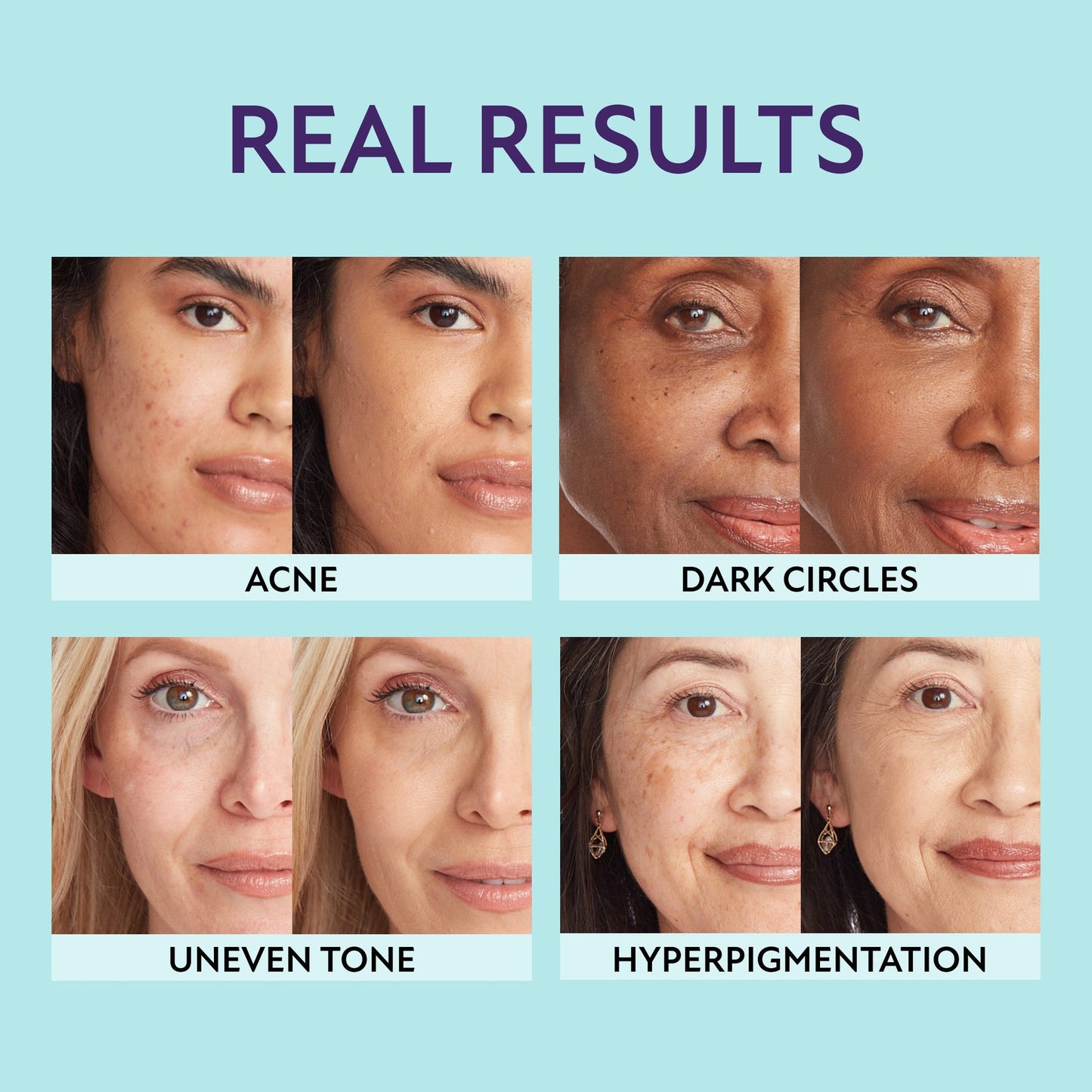 Seurico™ Cream - An all-in-one for moisturizing, concealing and coverage