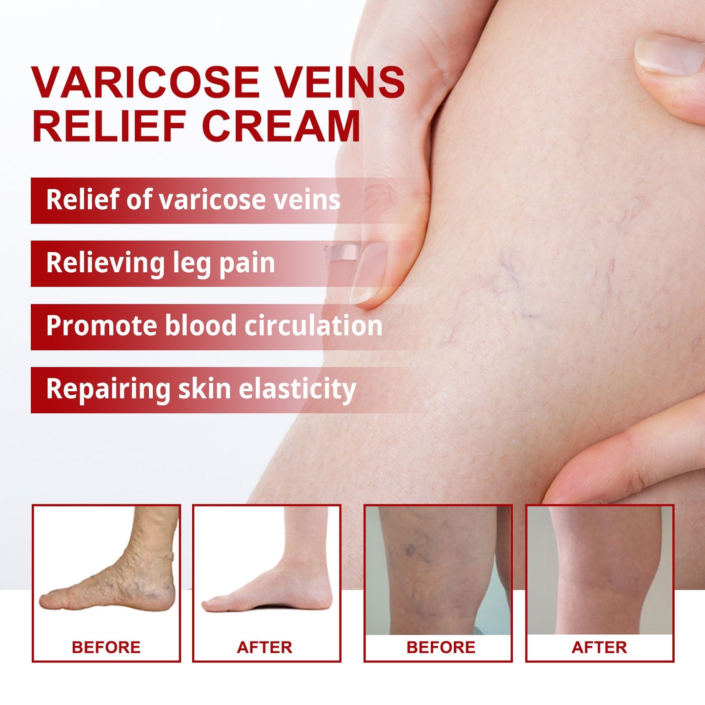 Seurico Varicose Veins Cream🔥