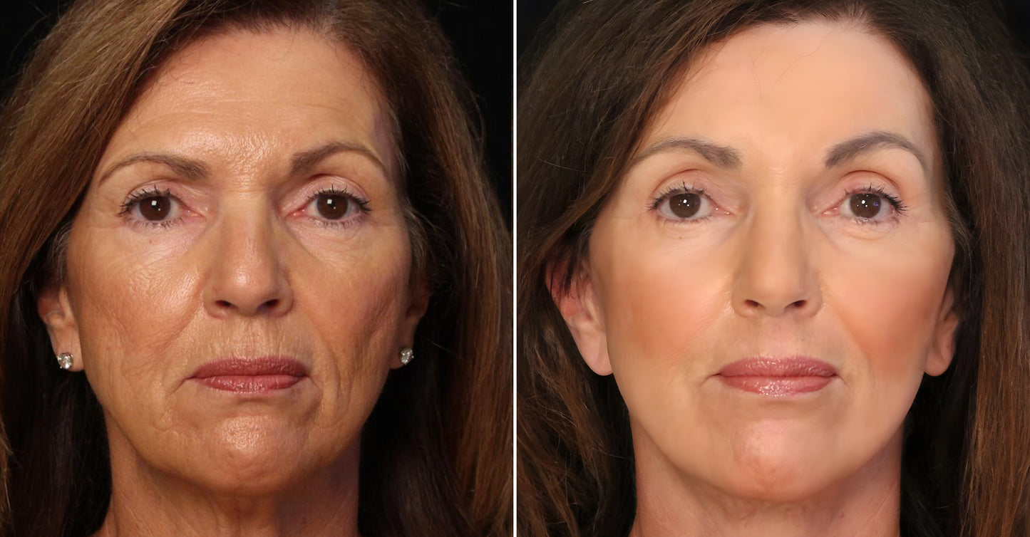 Seurico™ Luxury Collagen Firming Cream-Deep Wrinkles and Revives a Youthful