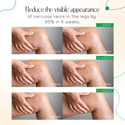 Vasculear™ Vein Therapy Cream