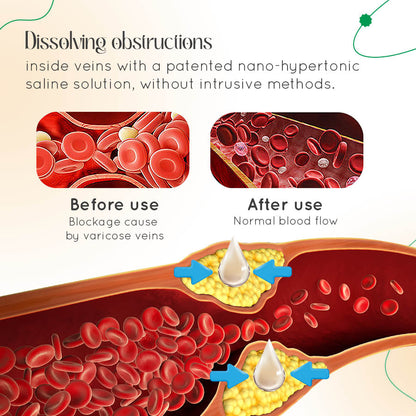 Vasculear™ Vein Therapy Cream