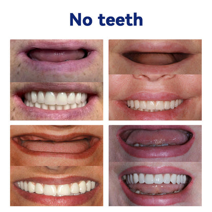 NEGUSY™ Silicone Denture Ruler Set (👩‍⚕️ADA Compliant Approved By Professional Dentists)