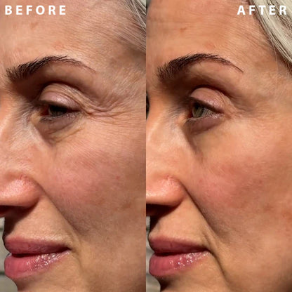 Seurico™ Luxury Collagen Firming Cream-Deep Wrinkles and Revives a Youthful
