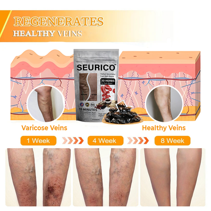 Seurico™ Herbal VenoDetox Foot Bath Beads🌲(𝐋𝐀𝐍𝐀 𝐂𝐞𝐫𝐭𝐢𝐟𝐢𝐜𝐚𝐭𝐢𝐨𝐧，𝗟𝘆𝗺𝗽𝗵𝗮𝘁𝗶𝗰 𝗔𝘀𝘀𝗼𝗰𝗶𝗮𝘁𝗶𝗼𝗻 𝗼𝗳 𝗔𝗺𝗲𝗿𝗶𝗰𝗮)