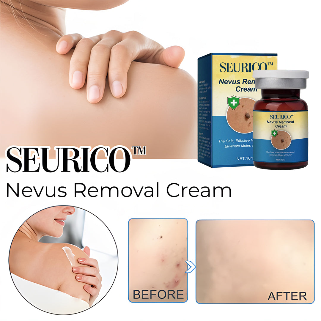Seurico™ Nevus Removal Cream