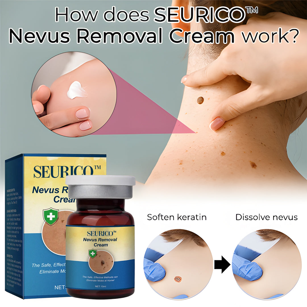 Seurico™ Nevus Removal Cream
